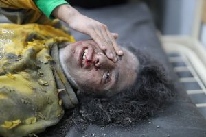 Injured Palestinian child lying on stretcher in Gaza – witness documentation of war crimes