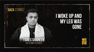 Fares Shaheen recovers in a hospital bed after losing his leg in the Nuseirat mall strike.