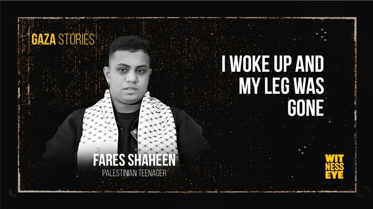 Fares Shaheen recovers in a hospital bed after losing his leg in the Nuseirat mall strike.